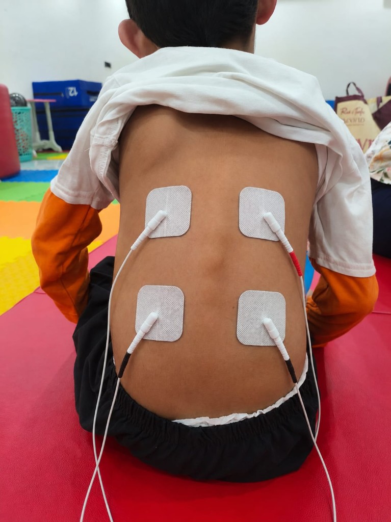 Functional electrical stimulation at NeuroGrow